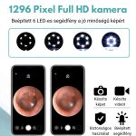 Bezdrátová sada na odstraňování ušního mazu s Wifi - černá