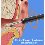 Bezdrátová sada na odstraňování ušního mazu s Wifi - černá