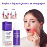 Eelhoe ínyápoló és fehérítő hab - 60 ml - Black Friday