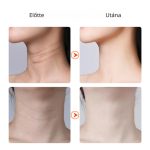 Intenzívna elektrická svetelná terapia - masážny prístroj na vrásky a spevnenie pokožky - ES-1081 - biely