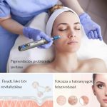 Dr. Pen M8 Dermapen Premium Bezdrôtové Microneedling pero s nastaviteľnou hĺbkou ihly a 6 rýchlosťami – Sivá